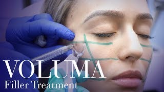 Runway Cheeks Voluma Cheek Filler [upl. by Rourke]