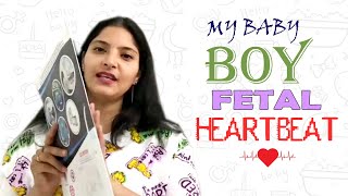 My Baby Boy Heartbeat in Pregnancy लड़का होने पर यह Heartbeat थी मेरी baby boy [upl. by Gow]