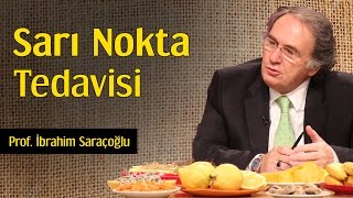 Sarı Nokta Tedavisi  Prof İbrahim Saraçoğlu [upl. by Yemerej933]