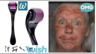 How NOT To Use A Derma Roller Graphic Please read description [upl. by Shanan]