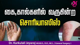 கை கால்களில் வருகின்ற சொரியாசிஸ்  Psoriasis  JKT SKIN CARE psoriasis treatment medicine [upl. by Gabriela542]