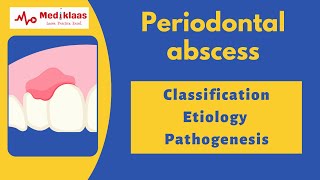 Periodontal Abscess Part 1  Classification etiology pathogenesis microbiology l Mediklaas [upl. by Gleich840]