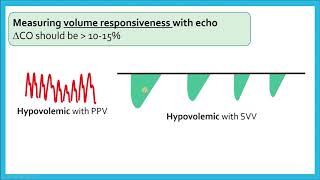 Assessing Cardiac Output and Volume Responsiveness  Critical Care Echo [upl. by Cheadle64]