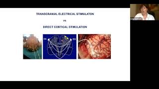 EANS Webinar Neuromonitoring in Vascular Neurosurgery [upl. by Amliw170]