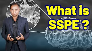 What is SSPE or Subacute Sclerosing Panencephalitis or Dowson Disease  Homeopathy Treatment amp Cure [upl. by Tibbetts]