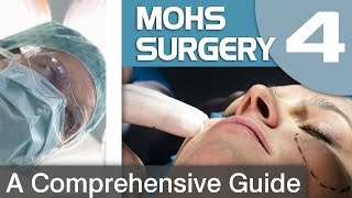 The Controversy Surrounding Melanoma and Mohs Surgery [upl. by Otreblaug]