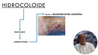 HIDROCOLOIDE Parte 2 [upl. by Sylvie313]