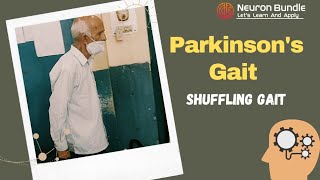 Shuffling Parkinson’s Gait  feature of parkinsonism gaitdisorders examination neurology [upl. by Ruhtracm]