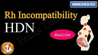 Rh Incompatibility Hemolytic Disease of the Newborn Erythroblastosis fetalis FLImmuno65 [upl. by Efthim]