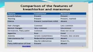 Malnutrition [upl. by Tlevesoor]