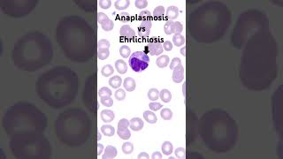 How to tell Anaplasmosis from Ehrlichiosis￼ [upl. by Ttcos]