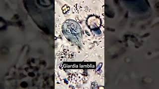 Giardia lambliaGiardiasis parasiteparasite under microscope microscopy parasitology [upl. by Midian]