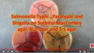 Salmonella enerica serotype Typhi amp Paratyphi growth on various media [upl. by Nerfe]