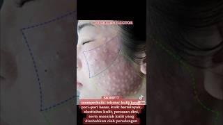 SkinFit Treatment With Koreabestdoctor operasiplastikkorea skintreatment skincarekorea oplas [upl. by Frodeen]