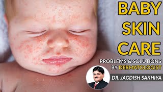 Baby Skin Care Tips  Babys Skin problems amp Solution by Dermatologist  in Hindi [upl. by Ainesey]