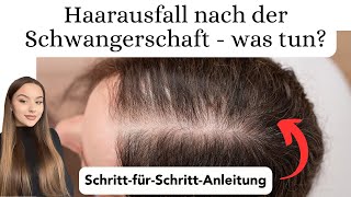 Haarausfall bekämpfen nach der Schwangerschaft [upl. by Erme]