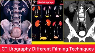 CT Urography Trace Ureters Filmy technique In Hindi  Cturography Radiologydept Ctscan ctkub [upl. by Nilre]