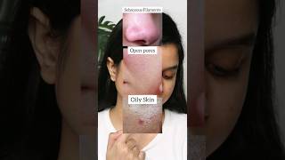 The Ordinary Niacinamide Vs Salicylic Acid Serum For Sebaceous Filament Open Pores amp Oily Skin [upl. by Jauch975]