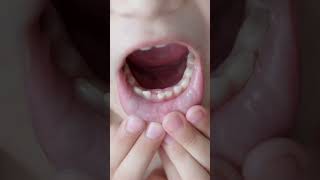 Real Reason behind Baby Teeth and Permanent Teeth viralvideo viralshorts viral shorts [upl. by Harlan]