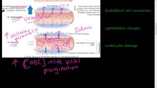 19  Acute Inflammation 1 of 3  Vascular permeability Vasodilation [upl. by Leta997]