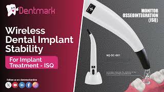 Wireless Dental Implant Stability For Implant Treatment  ISQ Monitor [upl. by Sualkcin]