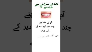 Masoro se khoon aane ka ilaj bleeding gums treatment bleedinggums trending viralvideo shorts [upl. by Cutlerr]