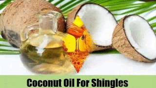 6 Popular Natural Treatments For Shingles [upl. by Anabella216]