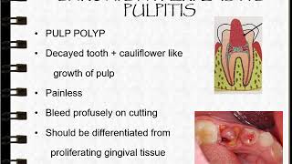 Sequelae of Pulpitis Part 1 [upl. by Pugh38]