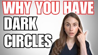 8 Reasons Why You Have Dark Circles [upl. by Ygiaf746]