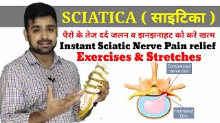 SCIATICA साइटिकाCausesSymptoms  Sciatic Nerve Pain Relief Exercises amp Stretches Hindi [upl. by Anneuq]