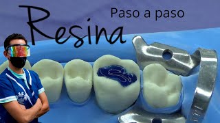 Como hacer una resina dental paso a paso [upl. by Arac]