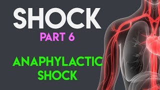 Anaphylactic Shock  Shock Part 6 [upl. by Neemsaj783]