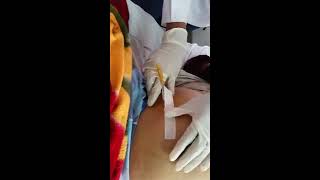 Tapping procedure for Ascites quot Paracentesis quot 1 [upl. by Richter]