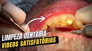 VIDEOS SATISFATÓRIOS Limpeza dos dentes [upl. by Milurd909]