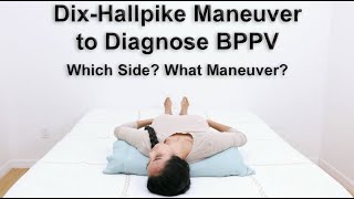 Dix Hallpike Maneuver to Diagnose BPPV  What Side and What Type for Proper Treatment [upl. by Akital]