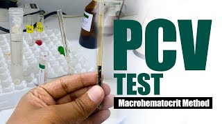 Packed Cell Volume Test  PCV Test   Macrohematocrit Method  Wintrobe tube method [upl. by Nahtannoj289]