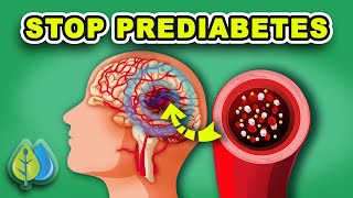 TOP 11 Prediabetes Symptoms and Treatment  How to STOP Prediabetes NOW [upl. by Nette872]