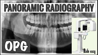 PANORAMIC RADIOGRAPHY II OPG II EXTRAORAL RADIOGRAPHY II ORAL RADIOLOGY [upl. by Stanwood519]