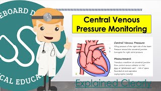 Central Venous Pressure CVP Monitoring and Measurement Basics [upl. by Ane]