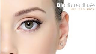 ❉ Powerful Blepharoplasty  Dark Circles amp Eye Bags Removal  Radiant Youthful Skin  Ocean Sounds [upl. by Eltsyrk327]