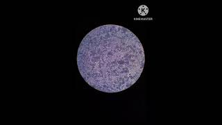 pinocytosis by paramecium DU biochemistry microscope study student [upl. by Yenitsed]