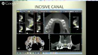 Mapping Vital Structures CT Machines and Scanning 1CE No Charge [upl. by Torosian]