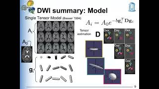 STOR701002 Lecture3 Diffusionweighted imaging and diffusion tensor image analysisI [upl. by Guarino]