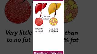 Fatty liver vs normal liver [upl. by Whorton]