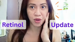 Luxe Organix Retinol Update after 6 months  Miamor delcel [upl. by Aihk]