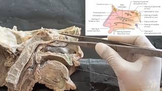 Dissection of lateral wall of nasal cavity  Anatomy of meatus and concha  structures within meatus [upl. by Raybourne]