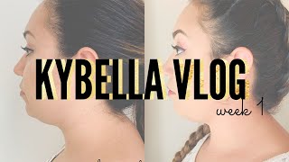 KYBELLA WEEK 1 VLOG  Full Process  Procedure  Downtime  Results  Before amp After [upl. by Enyar]