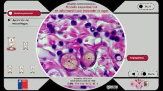 Imágenes Histopatológicas Modelo experimental de inflamación por implante de Agar [upl. by Eilis327]