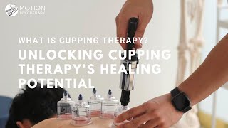 What Is Cupping Therapy Unlocking Cupping Therapys Healing Potential in Massage and Myotherapy [upl. by Hanselka415]