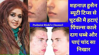 Shahanaz Hussain Beauty Tips for Remove PimplesAcneScarsBlemishesPigmentation amp Get Glowingskin [upl. by Adelaja995]